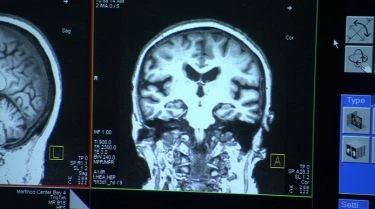 Projekt Alzheimer: Zázraky vědy (2009) [TV film]