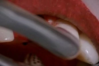 Dentista 2 (1998)