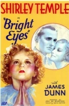 Zářící oči (Bright Eyes)