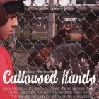 Calloused Hands