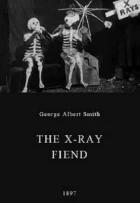 The X-Ray Fiend