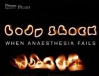 TV program: Selhání anestezie: Operace zaživa (Bodyshock: When Anaesthesia Fails)