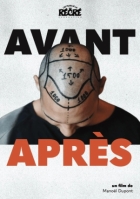 Před a po (Avant/Après)
